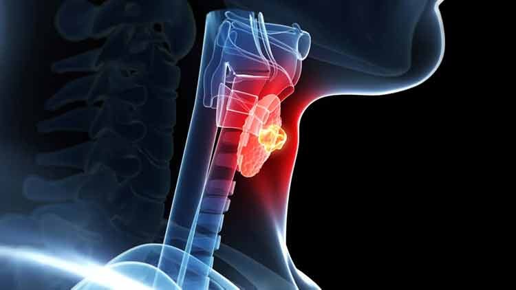 Thyroid throat animation 750