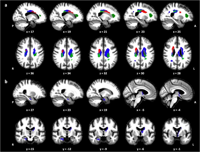 https%3A%2F%2Fsubstack post media.s3.amazonaws.com%2Fpublic%2Fimages%2Fa875ce8f 6c9b 4780 8bad