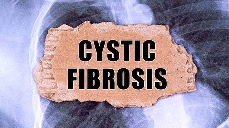 natural therapies for cystic fibrosis