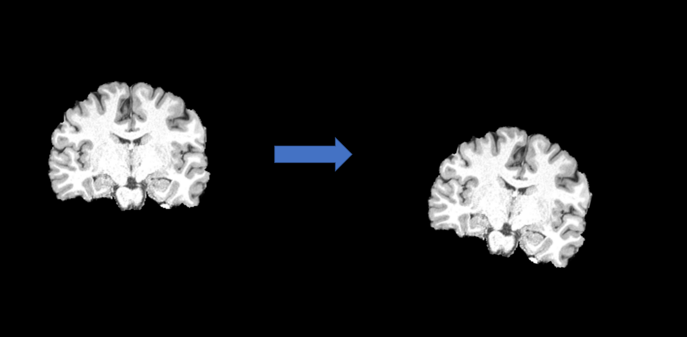 What Space Are You In? - by Ben Zimmerman - Brain Immortal