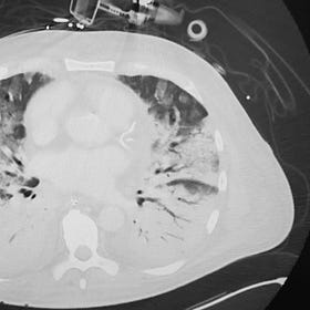 The Latest in Critical Care, 6/26/23 (Issue #6)