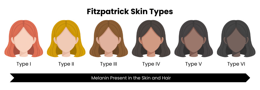Fitzpatrick Skin Types I, II, III, IV, V, VI, 1, 2, 3, 4, 5, 6