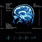 The Conscious And Subconscious Mind: Everything You Need To Know
