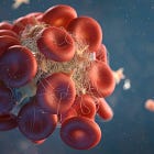 COVID vaccines increasing eye clot risk up to 2 years