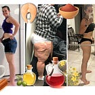LipedemaStories: Rebuilding a Life with Lipedema from the Inside Out