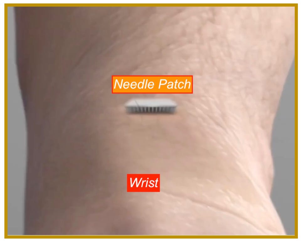 Microneedle Patch Implant—Will Your Silence Ensure It Succeeds?