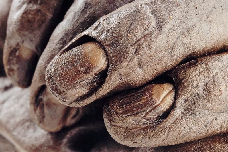 The truth about Irish bog bodies