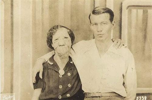 Grace McDaniels, born with a rare condition, and her son Elmer, photographed in the early 1940s. Grace built a lucrative career with Harry Lewiston’s Traveling Circus, a testament to her resilience.