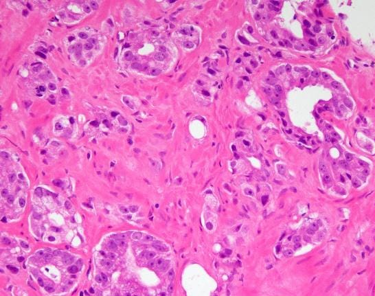 not 5-  a few single cells adjacent to small glands 4_1