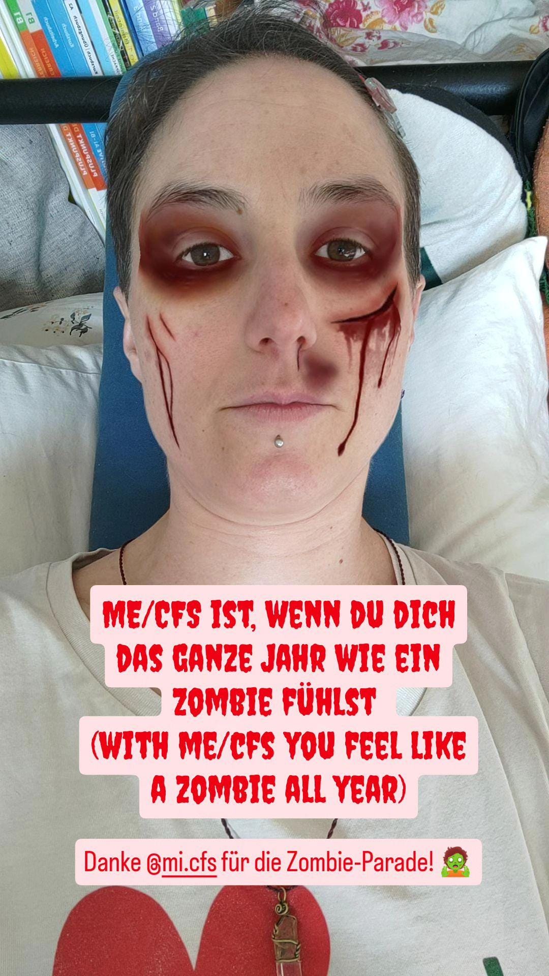 A white woman with short brown hair and a white T-shirt is lying in bed. She looks like a zombie because of a camera filter. The text on the images reads: With ME/CFS you feel like a zombie all year.
