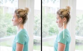 Retraction / Chin Tuck | Summit Orthopedics