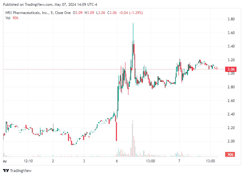 TradingView chart TradingView chart