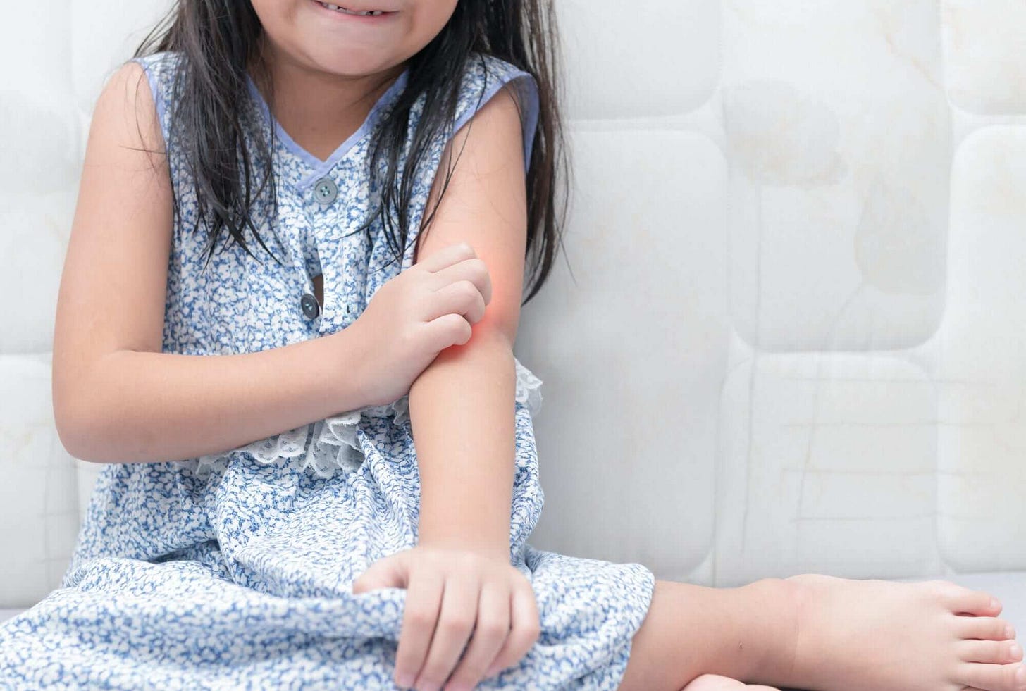 Follicolite Bambini: Cause e Rimedi da Applicare!