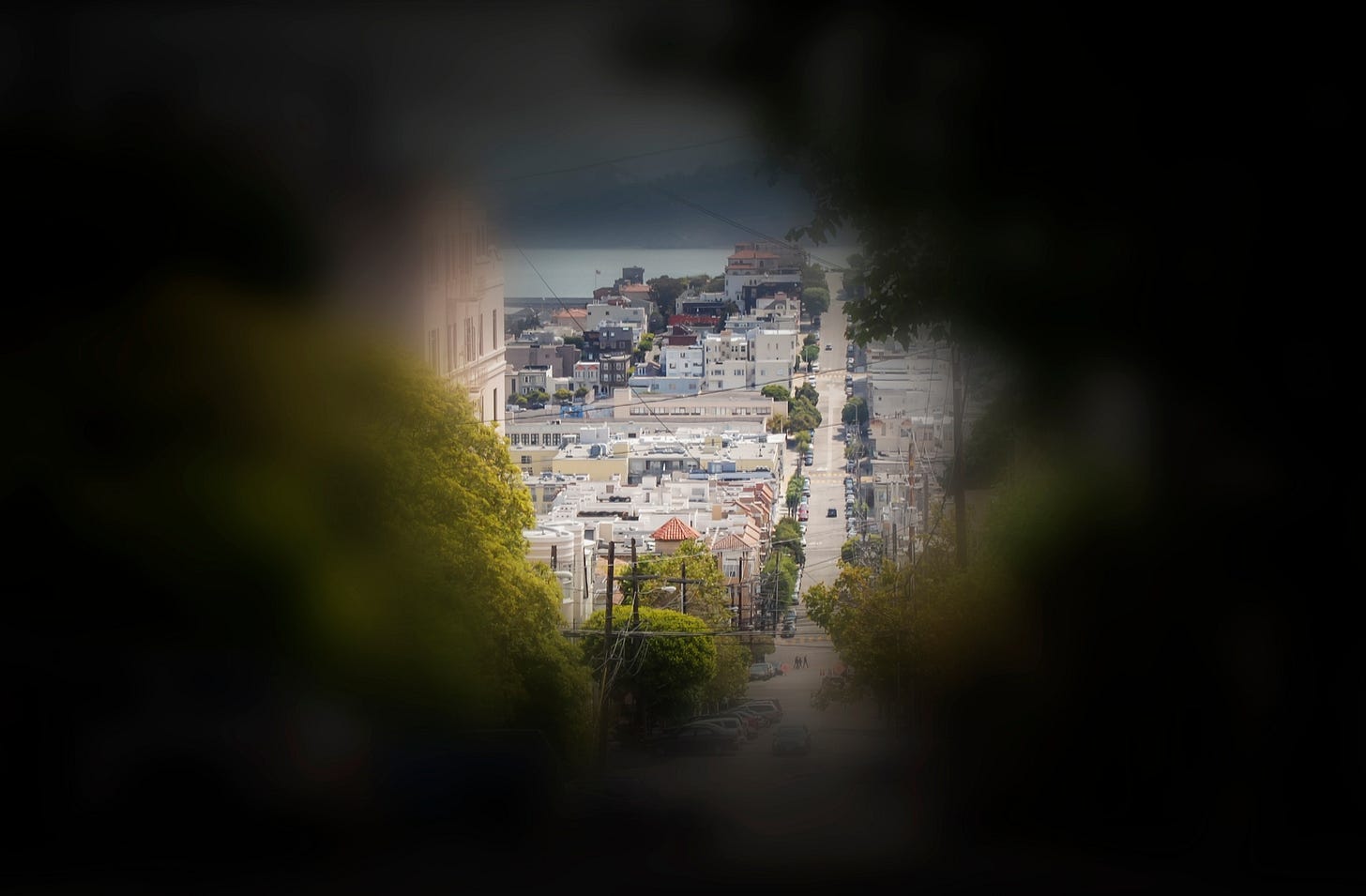 What Causes Tunnel Vision? Peripheral Vision Loss｜Brooklyn
