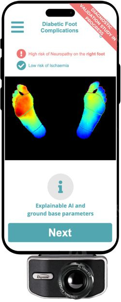 Dispositivo con la nueva aplicación de Inteligencia Artificial de Clinigram y la UCM (Foto cedida a ConSalud) (1)