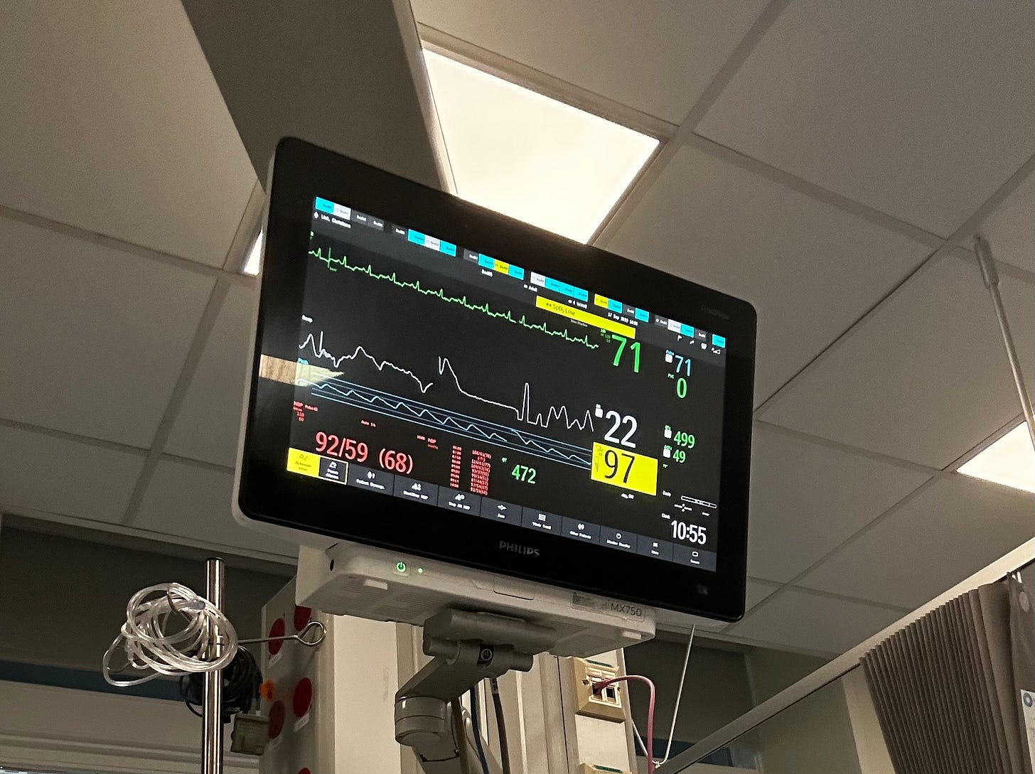 Heart monitor