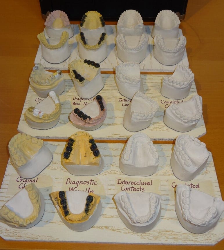 creepy plaster teeth molds!