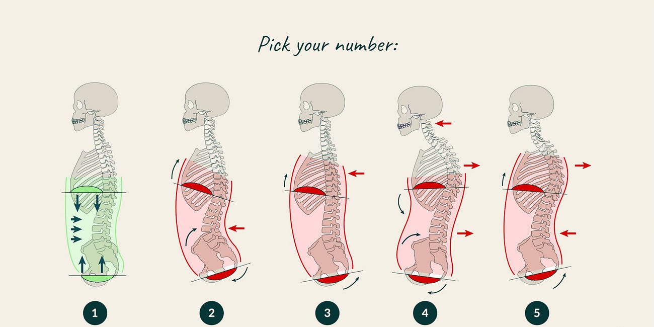 3 Postural Adaptations to Conditioning