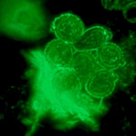 Fort Knox on a nanometer scale: a machine fortress in the blood
