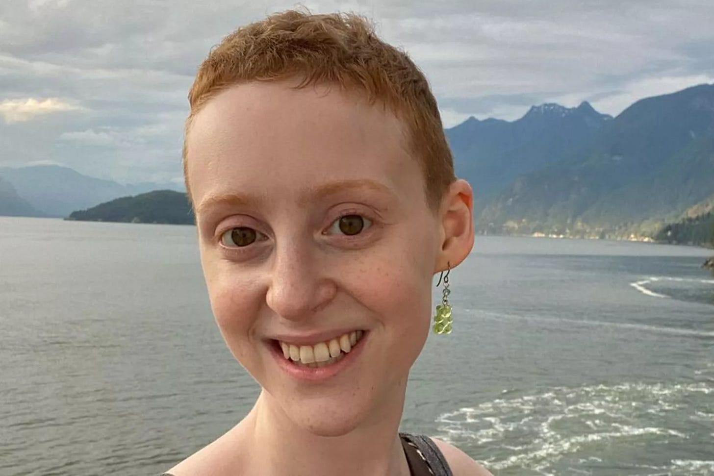 Actress Samantha Weinstein Dead at 28 from Ovarian Cancer Actress Samantha Weinstein Dead at 28 from Ovarian Cancer