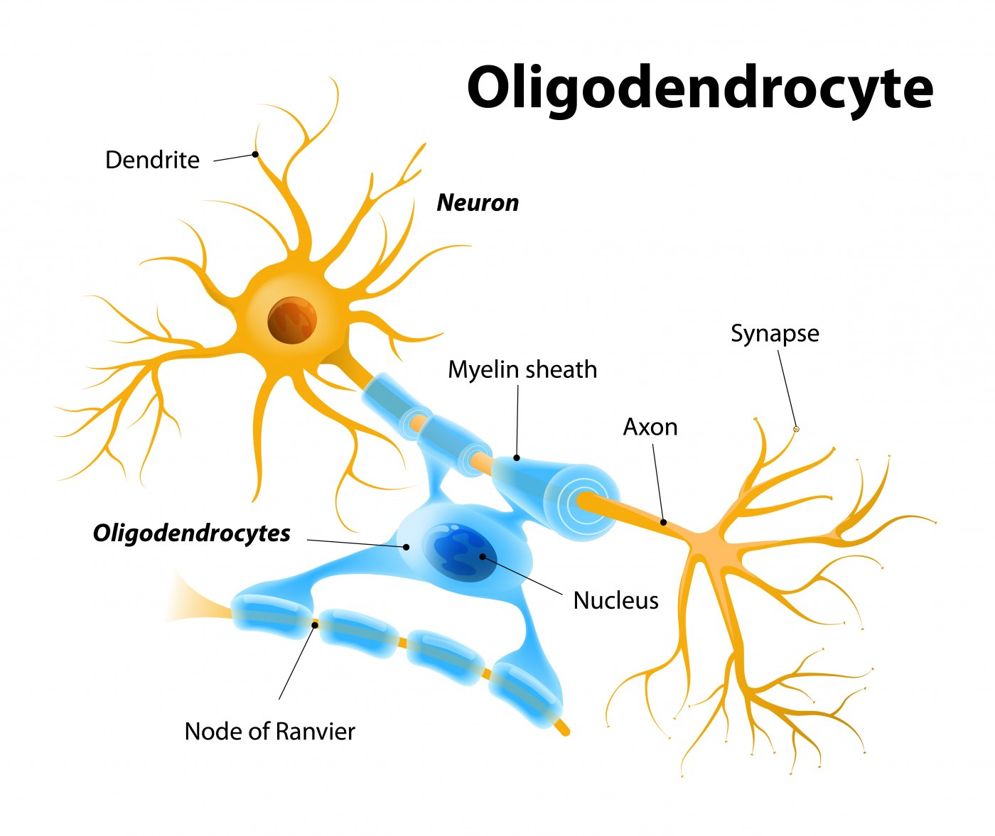 multiple sclerosis study multiple sclerosis study