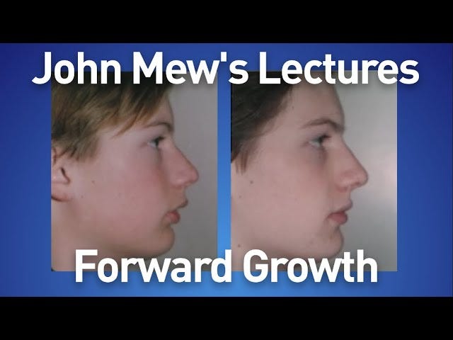 John Mew's lectures part 19: Forward Growth