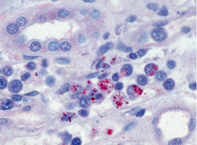 Ehrlichia - Galaxy Diagnostics