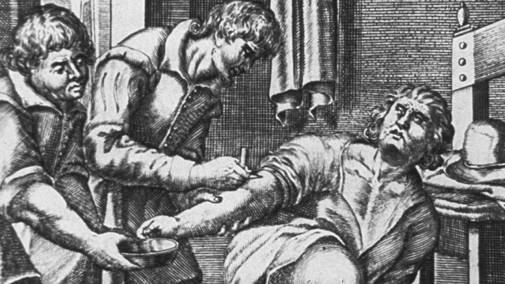 What is bloodletting, and why was it a popular therapy?