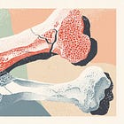 The Truth About Osteoporosis Most People Miss