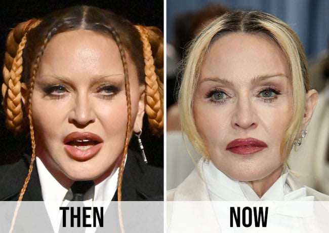 Madonna before and after Madonna before and after