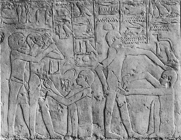 Circumcision scene from Saqqara, Egypt (ca. 2,500-3,000 BC) Circumcision scene from Saqqara, Egypt (ca. 2,500-3,000 BC)