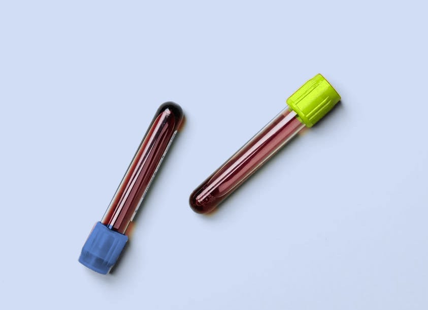 Two vials of blood with blue and lime green caps on a pale blue background.
