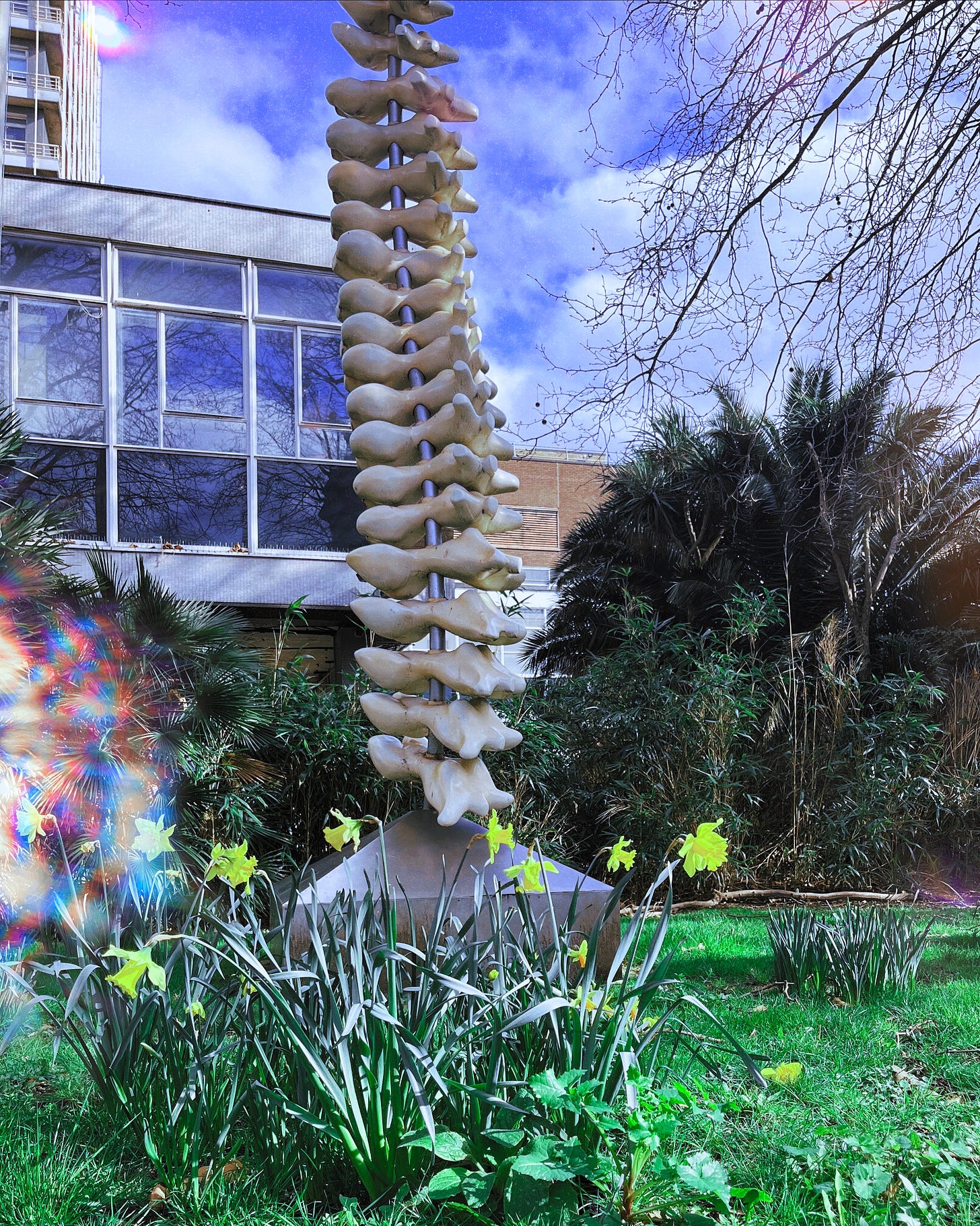 A large sculpture of a spine stands outside of a hospital building. It is on a small green lawn and there are daffodils blooming in front of it. There is a filter on the photo which makes little rainbow bursts appear on the left-hand side, similar to what some people see when they are having a migraine aura.