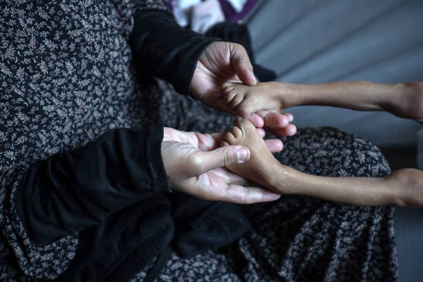 Palestinian mother changes the clothes of her five-year-old daughter, who suffers from malnutrition, at a shelter where they live after being...