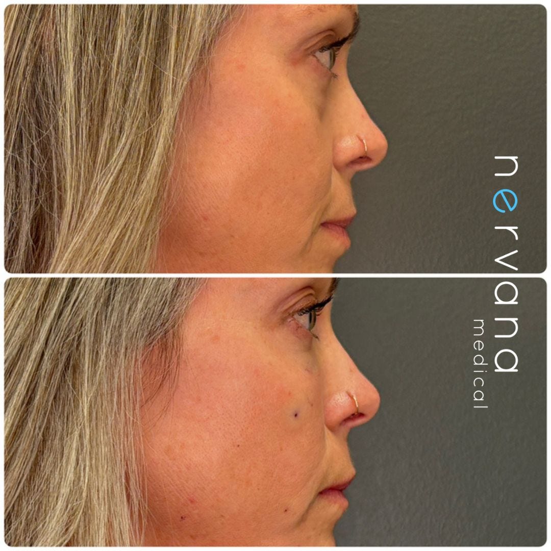 PRF/EZ Gel in Sandy, UT