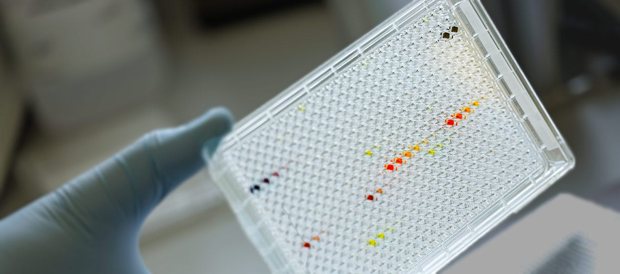 Linee cellulare tumorali sottoposte a indagine da parte del Cancer Dependency Map Consortium.
							Ctedit: Wellcome Sanger Institute, Genome Research Limited.