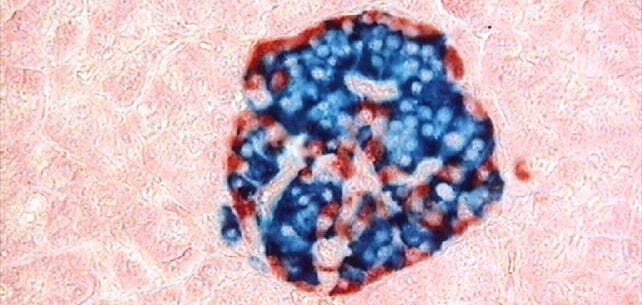 Islet Cells