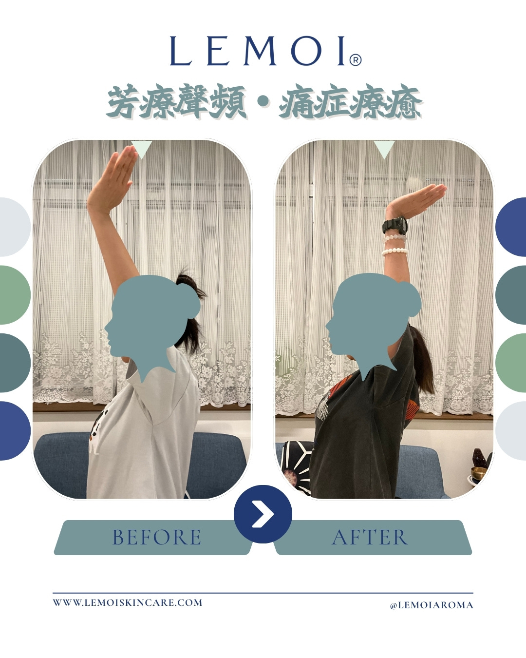 客人多月手部痛症而舉手困難，一度懷疑自己患上「五十肩」