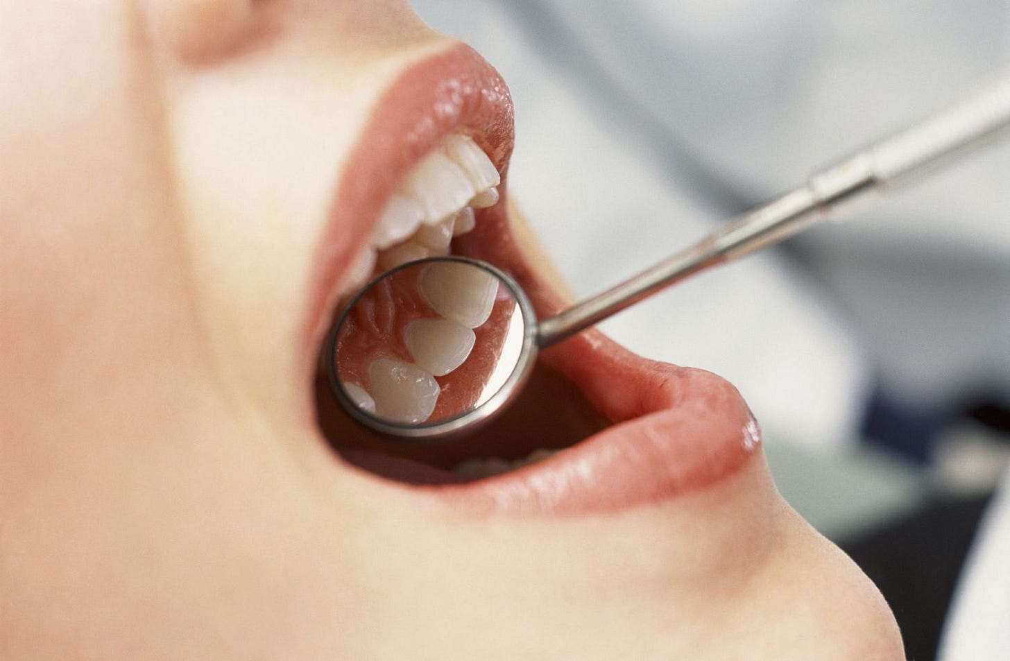 12 Common Teeth Problems