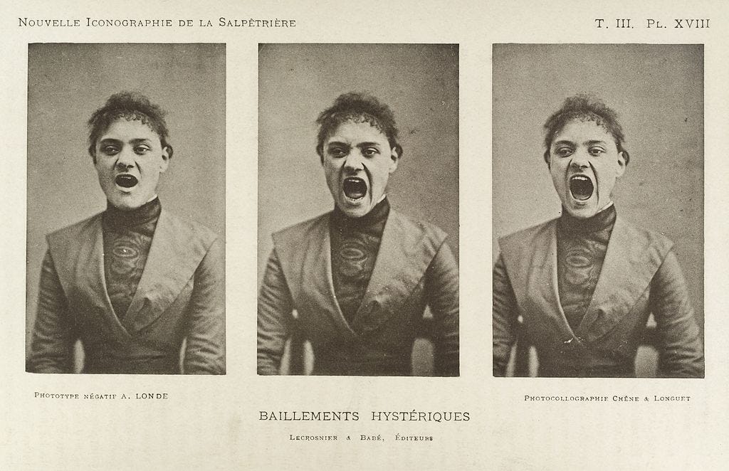https://upload.wikimedia.org/wikipedia/commons/thumb/0/0b/Series_of_three_photos_showing_a_hysterical_yawning_woman_Wellcome_L0034940.jpg/1024px-Series_of_three_photos_showing_a_hysterical_yawning_woman_Wellcome_L0034940.jpg