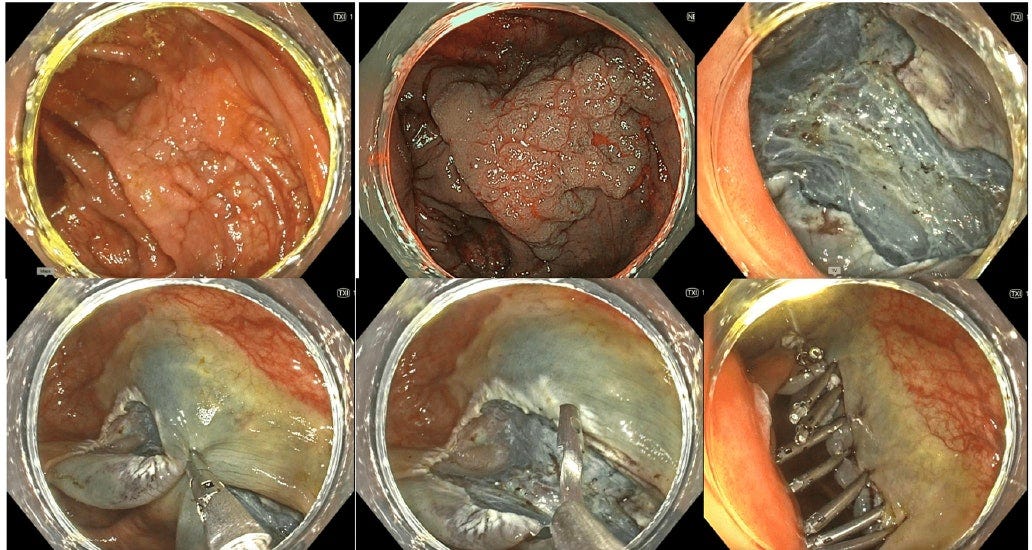 CleanShot 2026-03-10 at 11.49.46@2x.png CleanShot 2026-03-10 at 11.49.46@2x.png