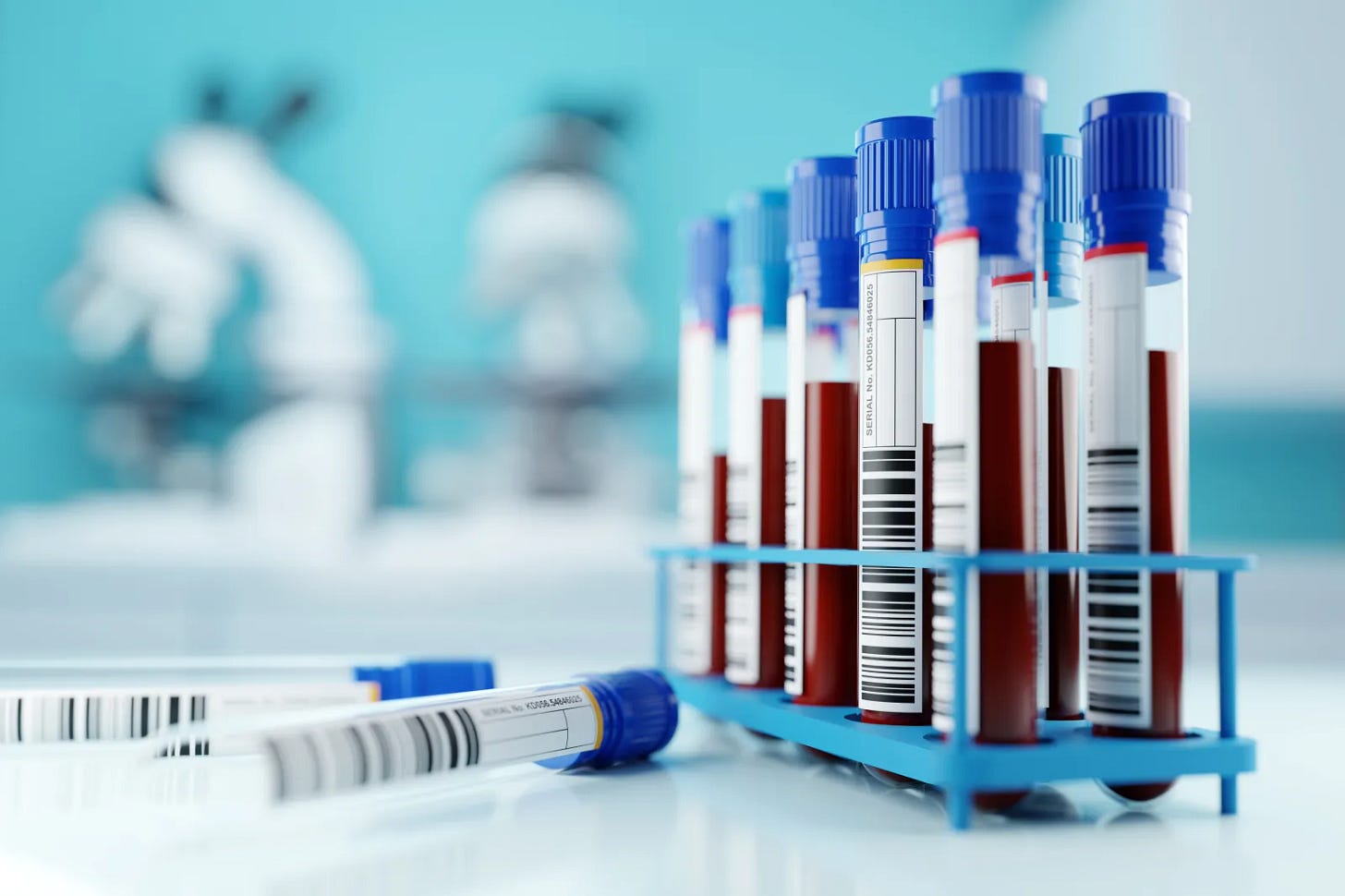 A stock image shows a row of human blood samples in a medical laboratory ready to be tested.