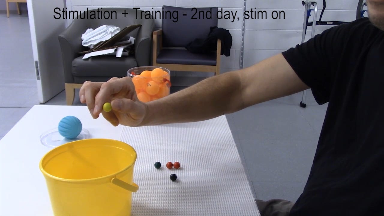 research subject demonstrates fine motor control of the hand by picking up small marbles and putting them into a bucket
