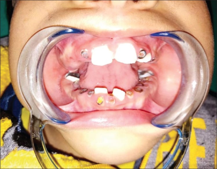 An external file that holds a picture, illustration, etc.
Object name is JFMPC-11-1191-g004.jpg