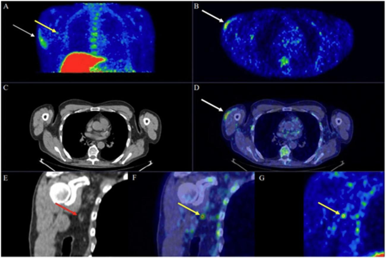 Scans of a right arm