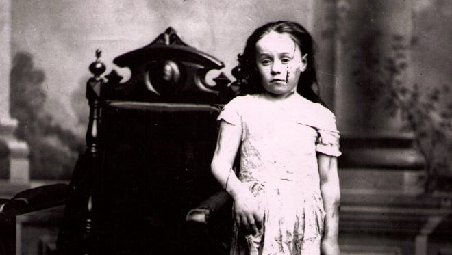 Horses had more protection than children when animal rights activists went to court in New York City on behalf of Mary Ellen Wilson. She told the judge: “Mama has been in the habit of whipping and beating me almost every day,” according to an 1874 New York Times story. She was photographed in the only clothes she had at the time of her rescue.