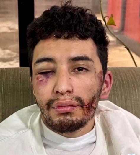 ICE attacking peaceful protesters and taking children from their family. Police attacking peaceful protesters in Selma, Alabama. 