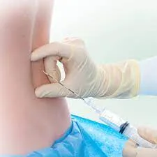 tuohy epidural needles