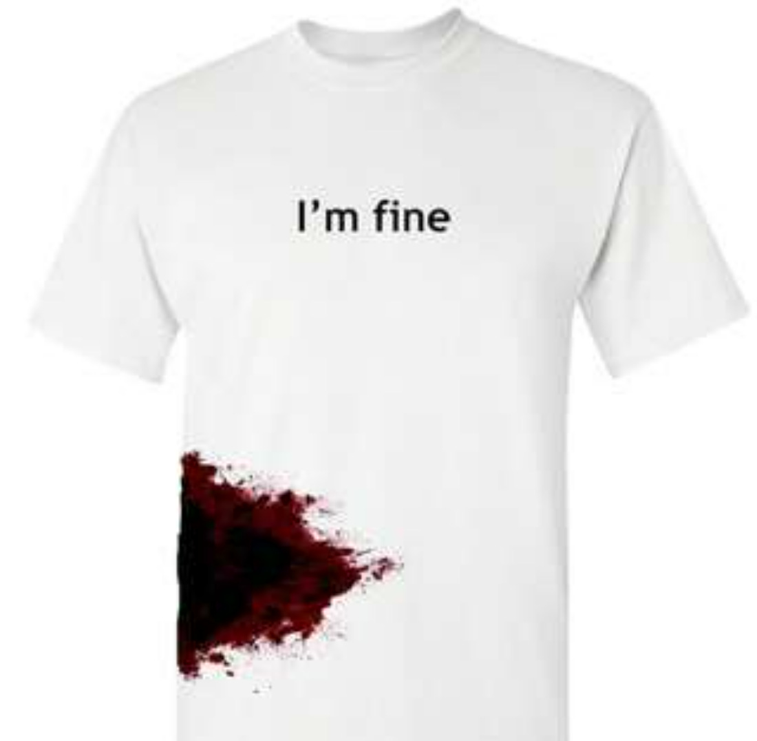 Tshirt with bloody shark bite on site and text that says I'm fine