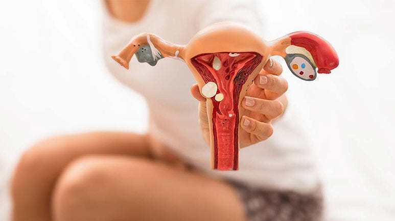 endometriosis fusobacterium